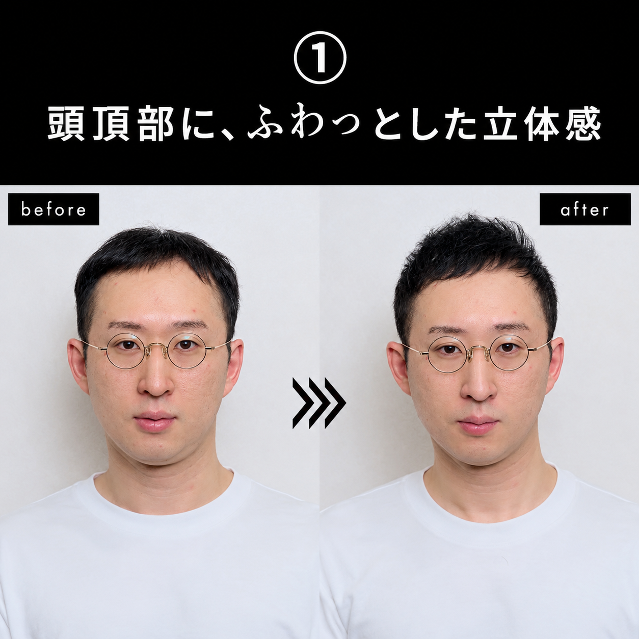 ビフォーアフター 頭頂部にふわっとした立体感