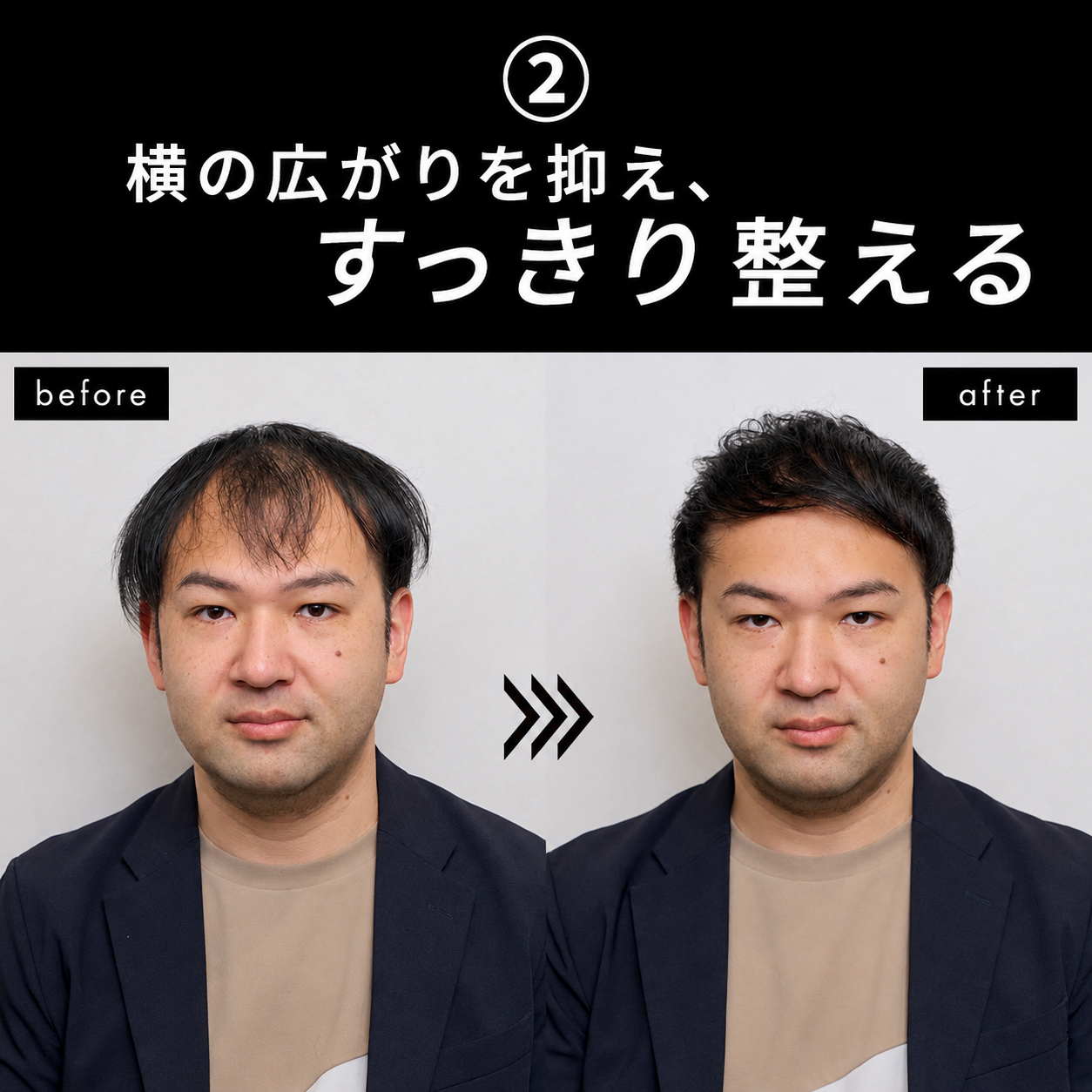 ビフォーアフター 横の広がりを抑えすっきり整える